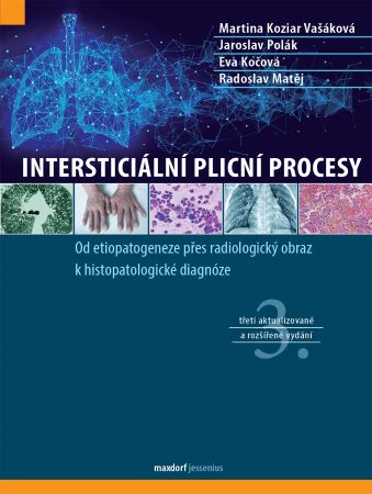 Intersticiální plicní procesy (3. aktualizované a rozšířené vydání ) - 