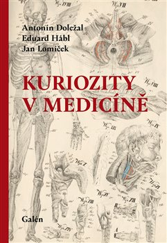 Kuriozity v medicíně - 