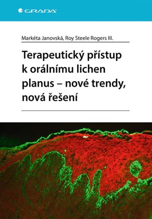 Terapeutický přístup k orálnímu lichen planus - nové trendy, nová řešení - 