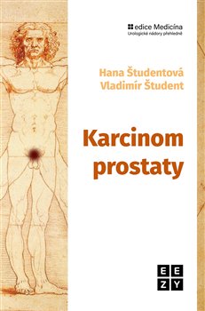 Karcinom prostaty - 